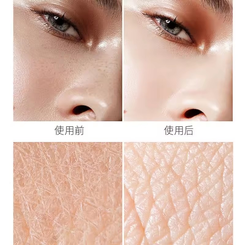 Гиалуроновая кислота, ниацинам – обзор и цена Niacinamide Pore Shrinking Essence