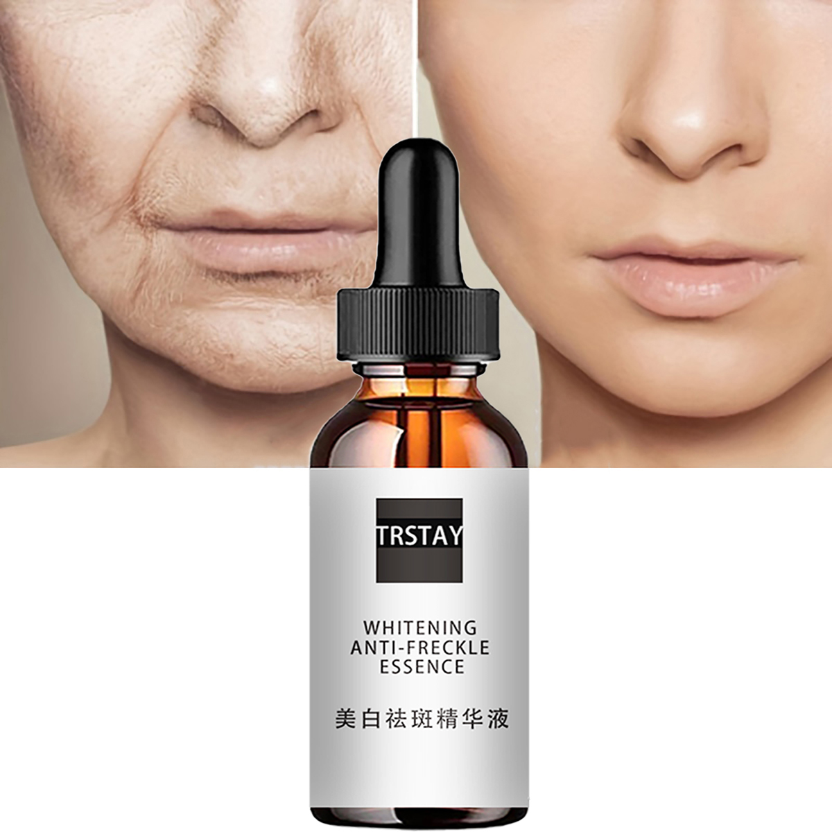 Ниацинамид, кислота, эссенции  – обзор и цена Niacinamide Pore Shrinking Essence