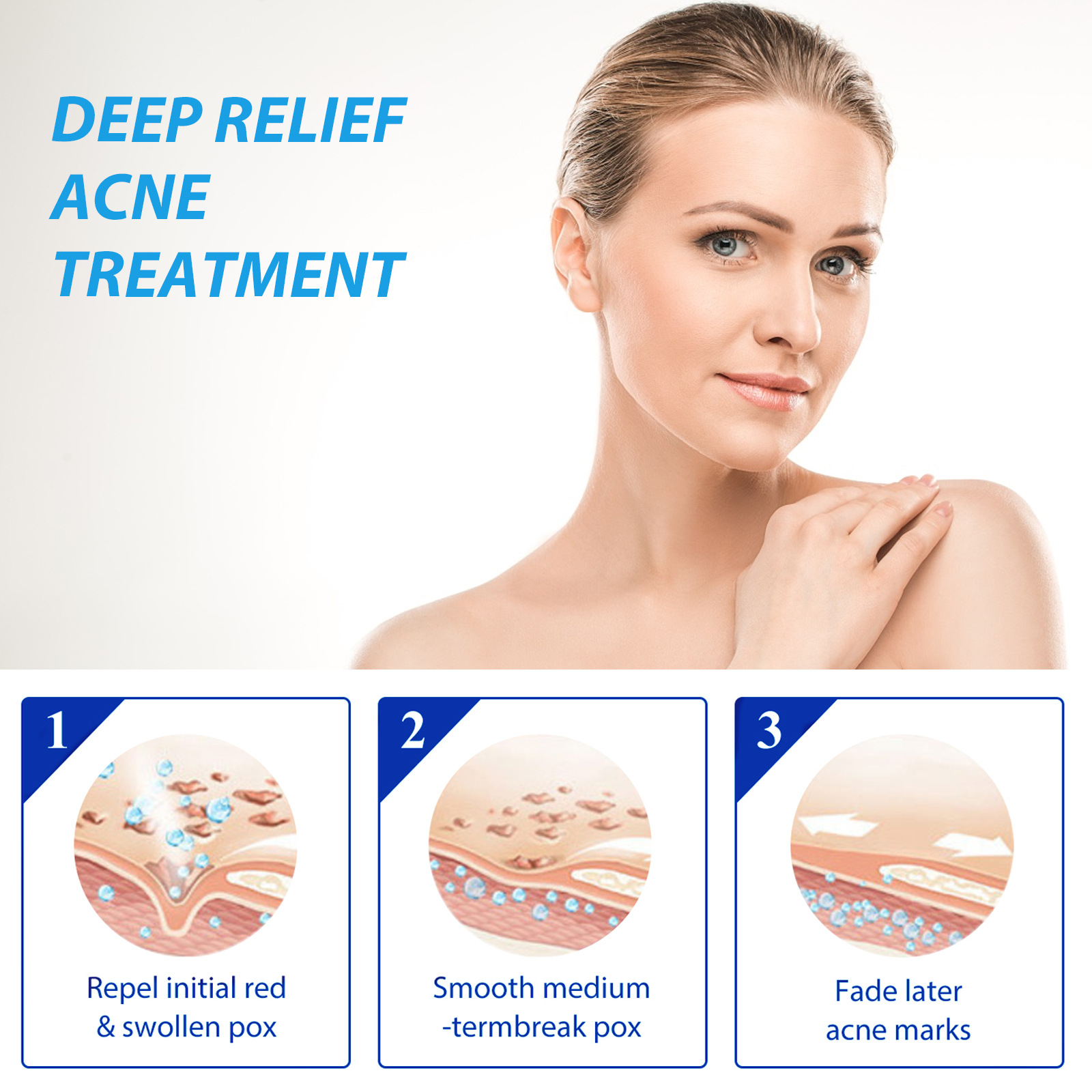 EELHOE лосьон для лечения прыщ – обзор и цена Salicylic Acid Blackhead Remover